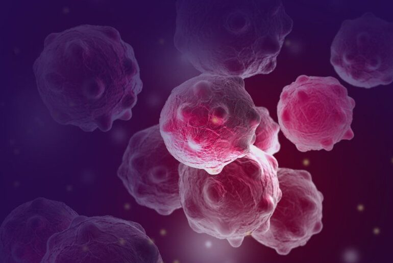 Treatment of Cancer Treatment OF Cancer