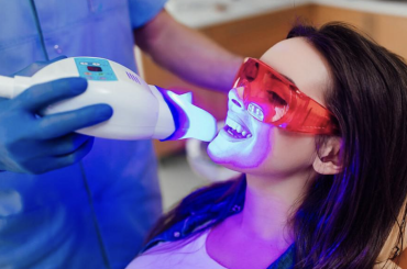 Give Your Smile a Dazzle with Dental Veneers