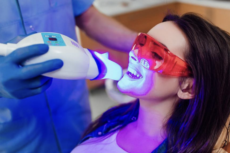 Give Your Smile a Dazzle with Dental Veneers