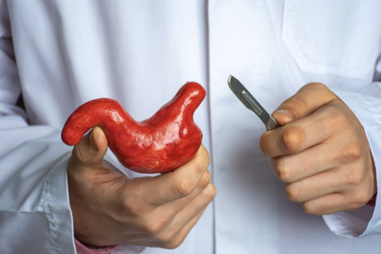 Types Of Bariatric Surgery