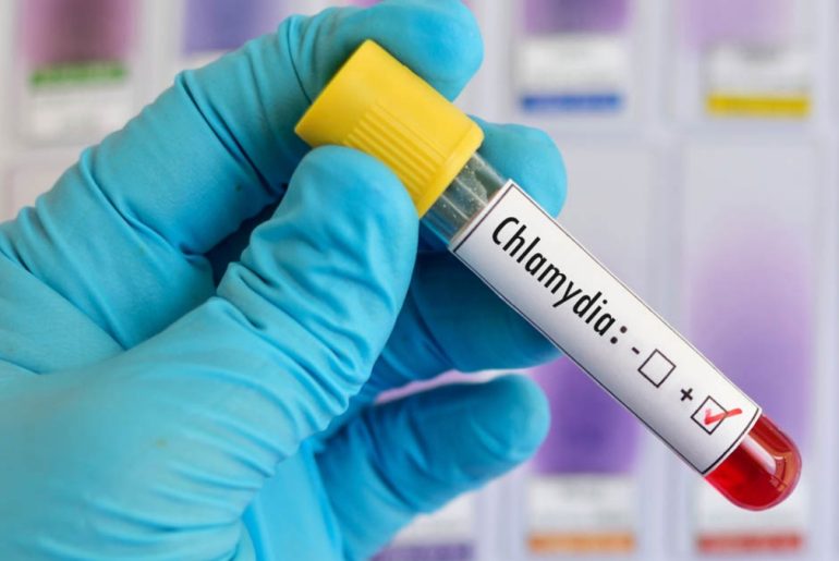 An Ultimate Guide to Understanding Chlamydia Infections An Ultimate Guide to Understanding Chlamydia Infections