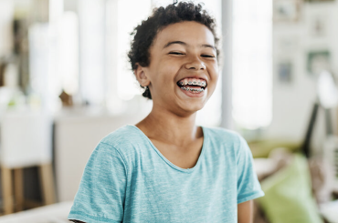 Benefits Of Clear Braces You Should Know About