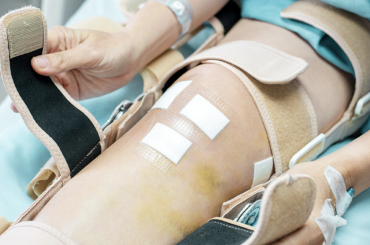 Everything you need to Know about Knee Arthroscopy