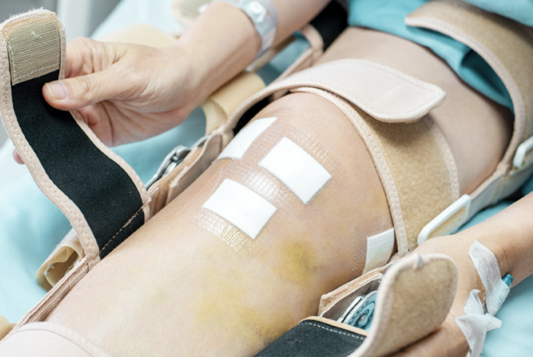 Everything you need to Know about Knee Arthroscopy