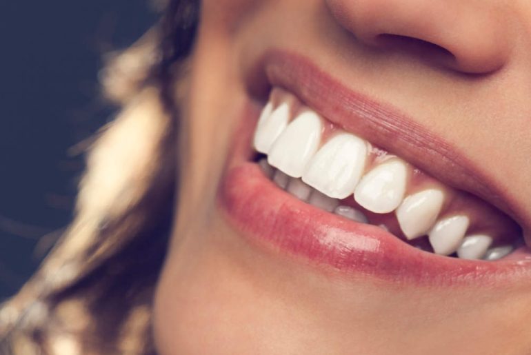 Types Of Teeth Whitening Techniques You Can Try In 2022