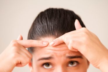 Effective Remedies For Clearing Out Acne