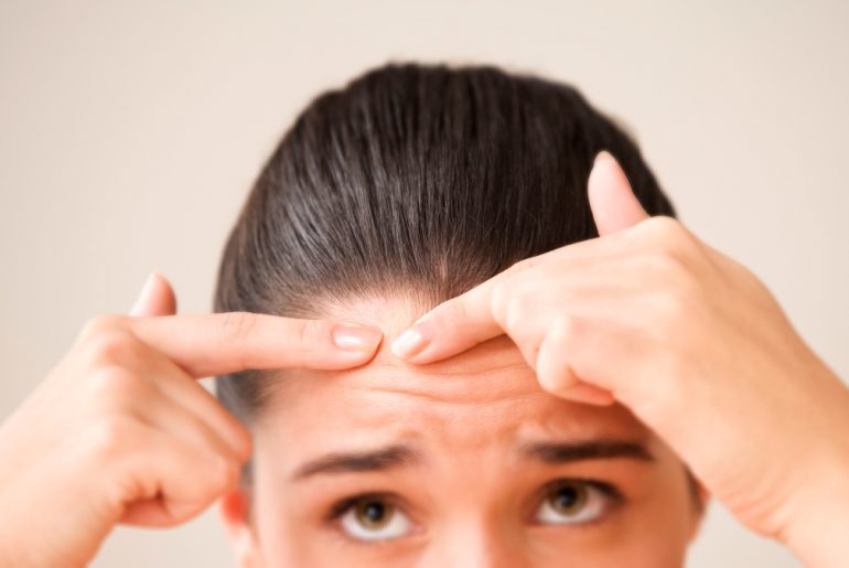 Effective Remedies For Clearing Out Acne