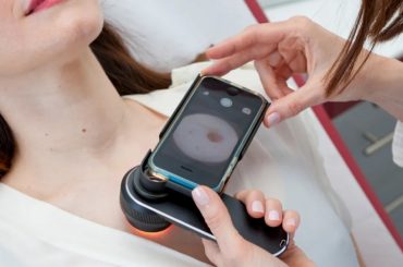 Effective Skin Cancer Screening