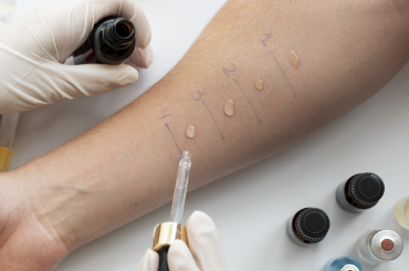 Is Food Allergy Testing Worth It? Is Food Allergy Testing Worth It?