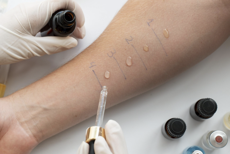 Is Food Allergy Testing Worth It? Is Food Allergy Testing Worth It?