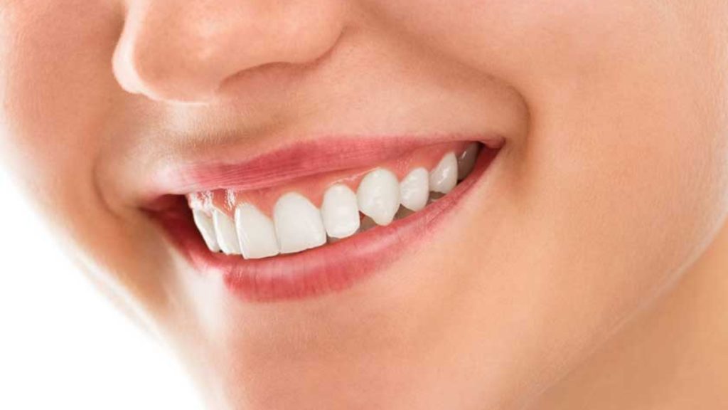 Teeth whitening and its Benefits