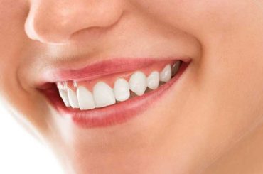 Teeth whitening and its Benefits