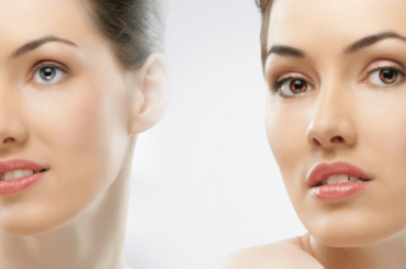 What To Expect During Removal of A Mole?