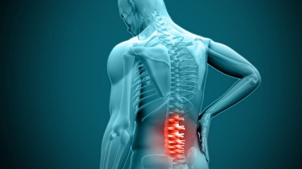 What You Can Expect on Your Herniated Disc Diagnosis Appointment