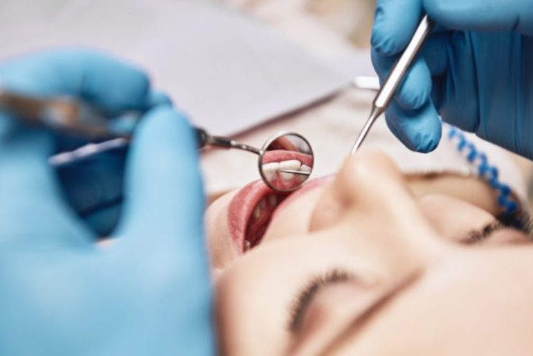 What You Need to Know About Gingivitis? What You Need to Know About Gingivitis?