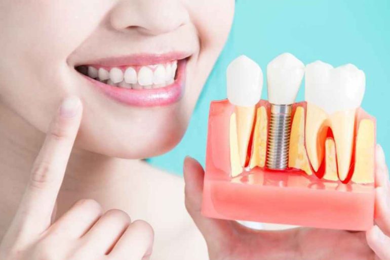 Is The Ultratooth The Ultimate Modern Dentistry Procedure? Is The Ultratooth The Ultimate Modern Dentistry Procedure?
