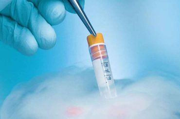 When to Consider Sperm Freezing