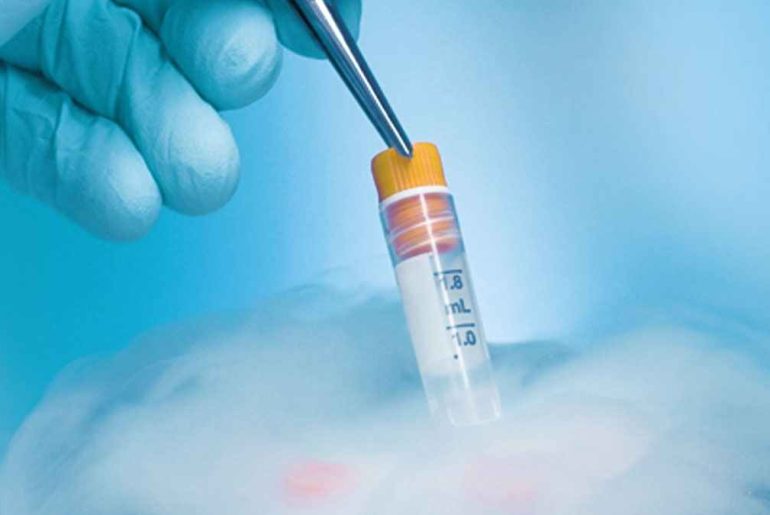 When to Consider Sperm Freezing