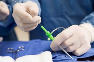 The Duration of A Cardiac Catheterization