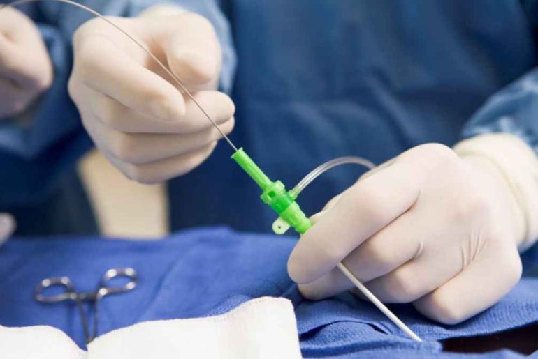 The Duration of A Cardiac Catheterization