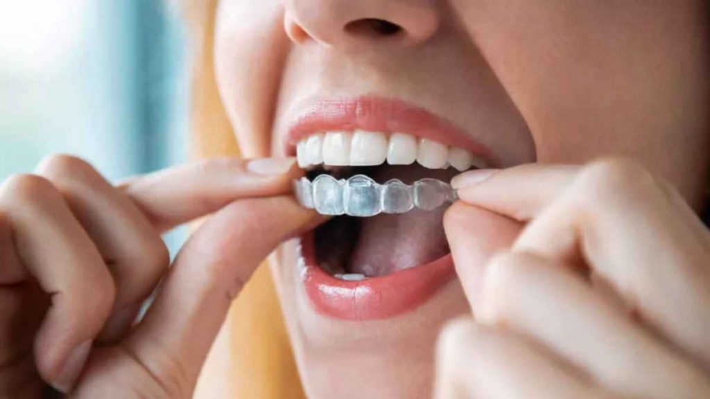 Tips to Help You Take Care of Your Invisalign Aligners