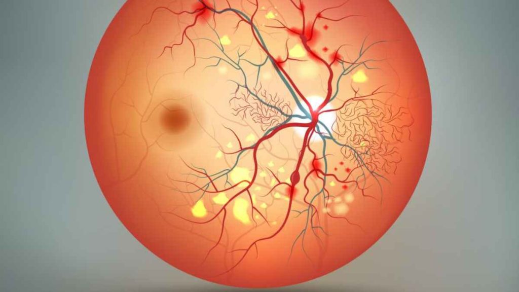 Understanding The Early Warning Signs Of Diabetic Retinopathy