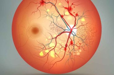 Understanding The Early Warning Signs Of Diabetic Retinopathy