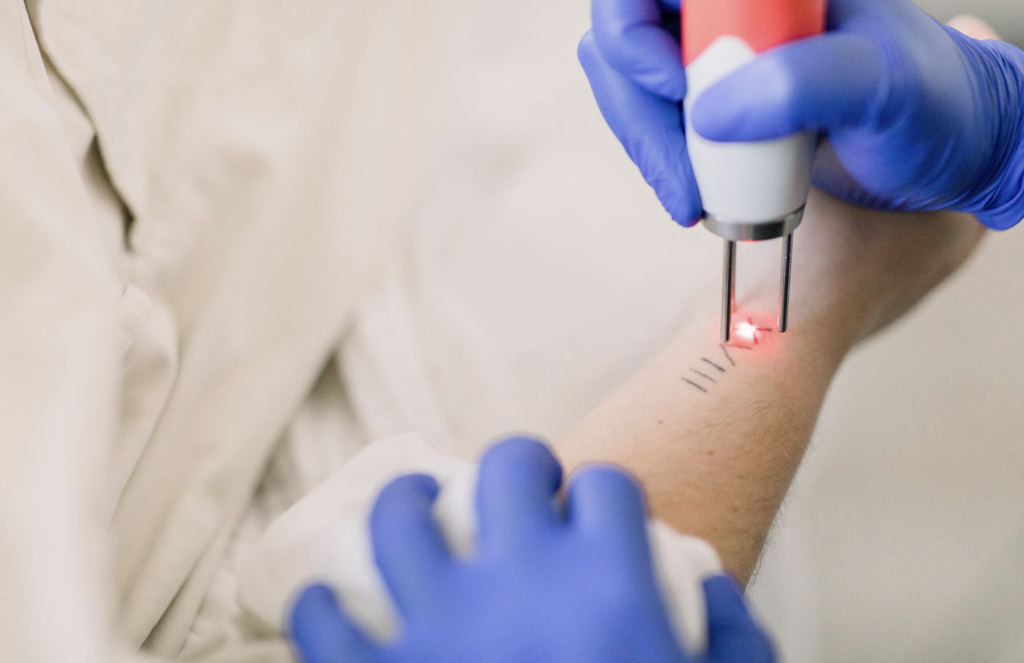 What Is Laser Tattoo Removal?