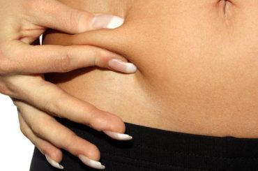 A Closer Look into Liposuction