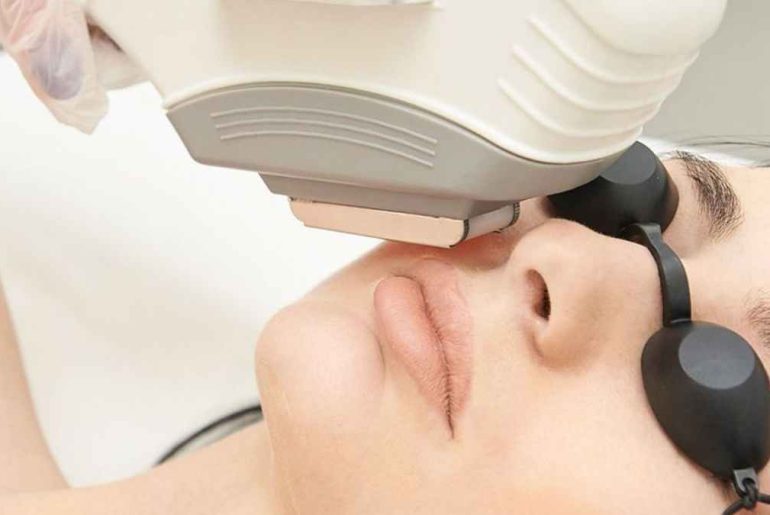 Do This Before Laser Hair Removal for Better Results