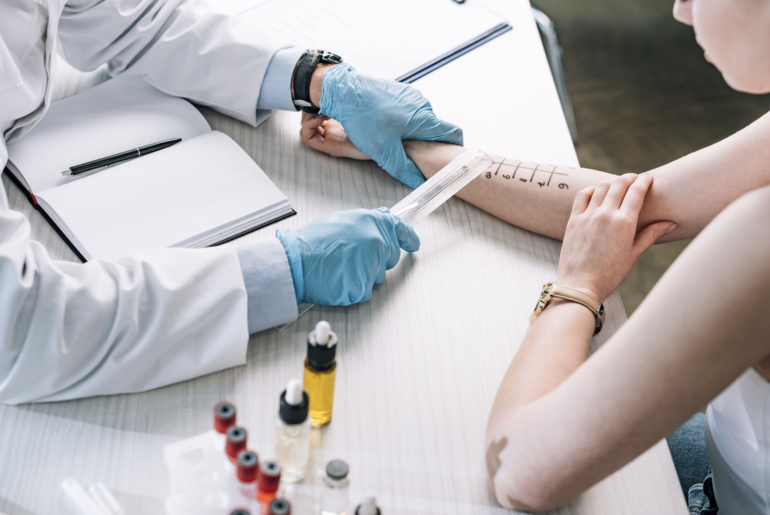 Why You Should Have an Allergy Test