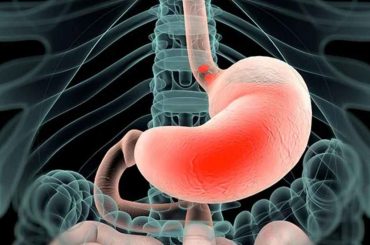 Common Signs You May Be Suffering From GERD/Acid Reflux