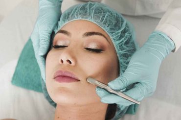 Common Scar Revision Procedures