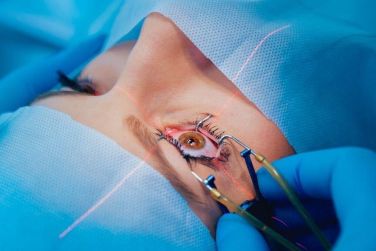What Is LASIK Surgery?