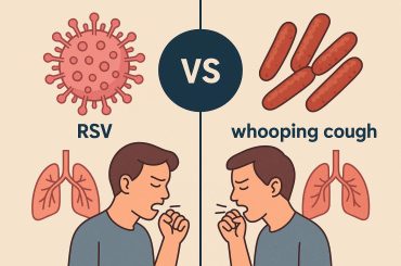 Visual comparison of RSV and whooping cough symptoms in infants for health awareness